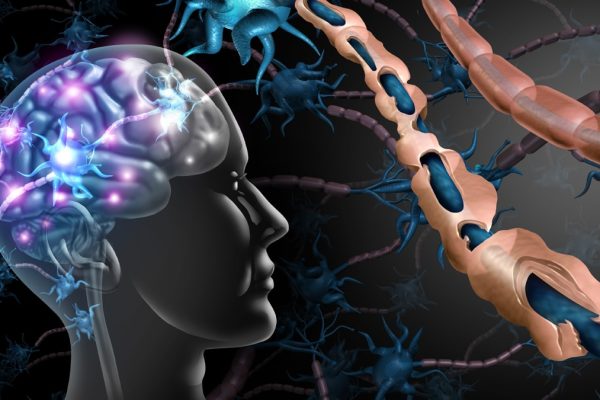 Kadınları Daha Fazla Etkiliyor: 20-40 Yaş Arası Teşhis Edilen Sessiz Tehlike MS Hastalığı