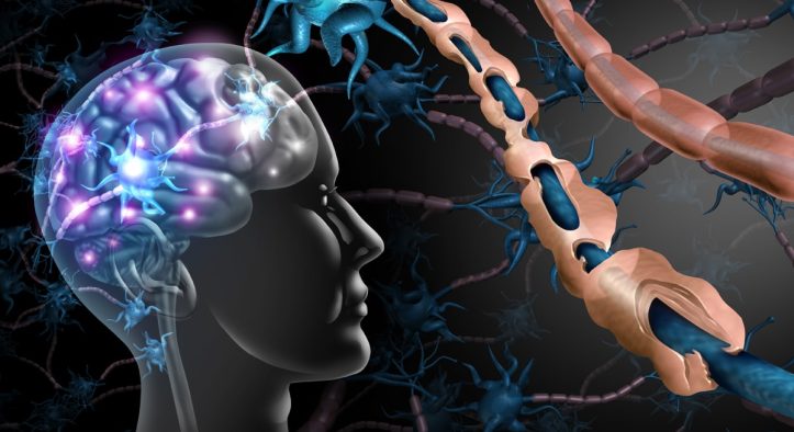 Kadınları Daha Fazla Etkiliyor: 20-40 Yaş Arası Teşhis Edilen Sessiz Tehlike MS Hastalığı